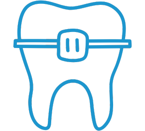 Traditional Braces