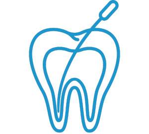 Root Canal Treatment